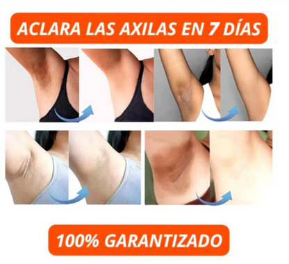 CREMA ACLARADORA ¡DILE ADIOS A LAS MANCHAS Y LUCE UNA PIEL RADIANTE! + ENVIO GRATIS