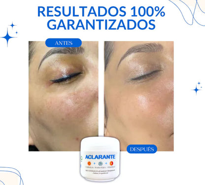 CREMA ACLARADORA ¡DILE ADIOS A LAS MANCHAS Y LUCE UNA PIEL RADIANTE! + ENVIO GRATIS