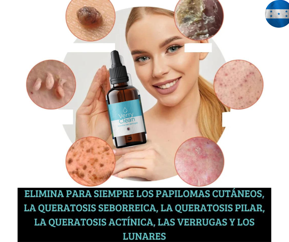 Dile adios a las verrugas con VerruCler + Envio Gratis